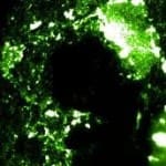 "Microscopic stain showing living bacterial colonies in green"