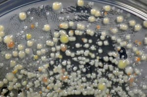 Determining the most appropriate biodegradability test method begins with understanding the a product's solubility and material composition.