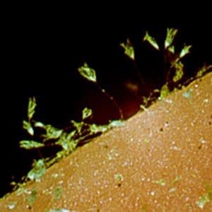 Mold fungi growth on surface of pink silicone.